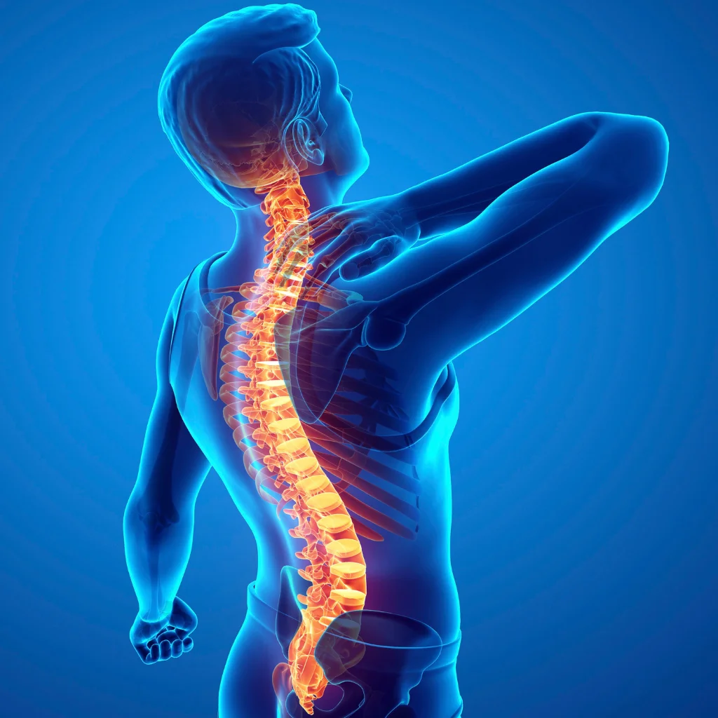 Illustration of a lower spine with the painful area highlighted