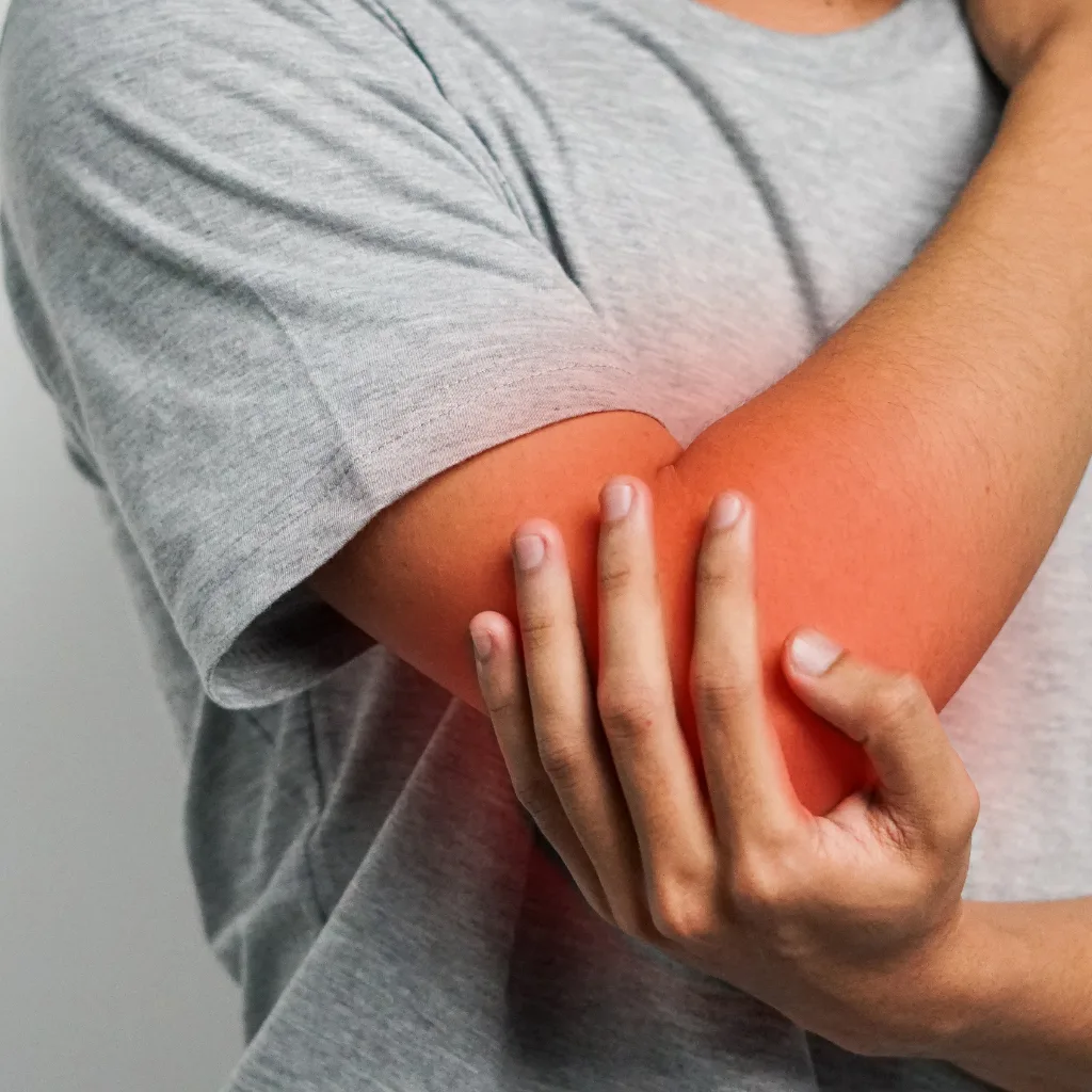 Man cradling his elbow with the outer joint flushed red where tennis elbow pain sits
